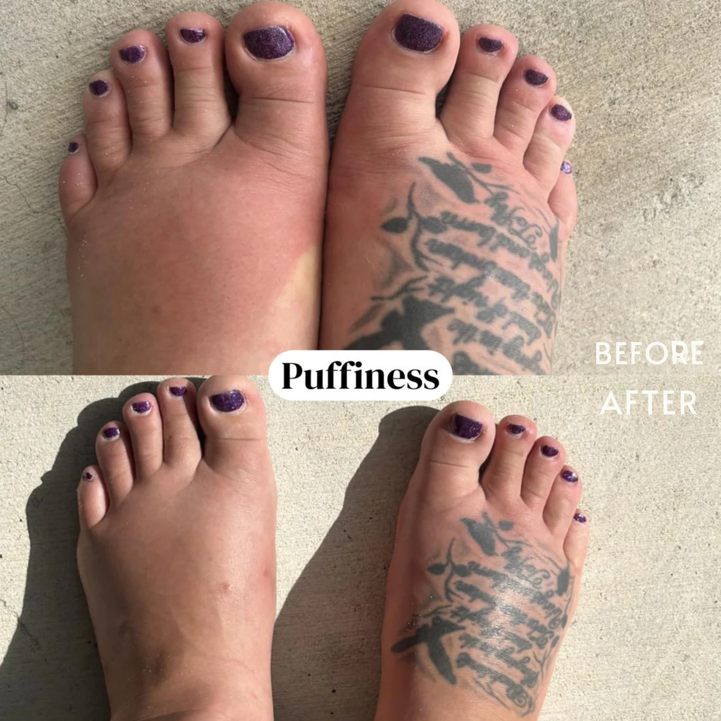 nood - Organic Lymphatic Drainage Drops