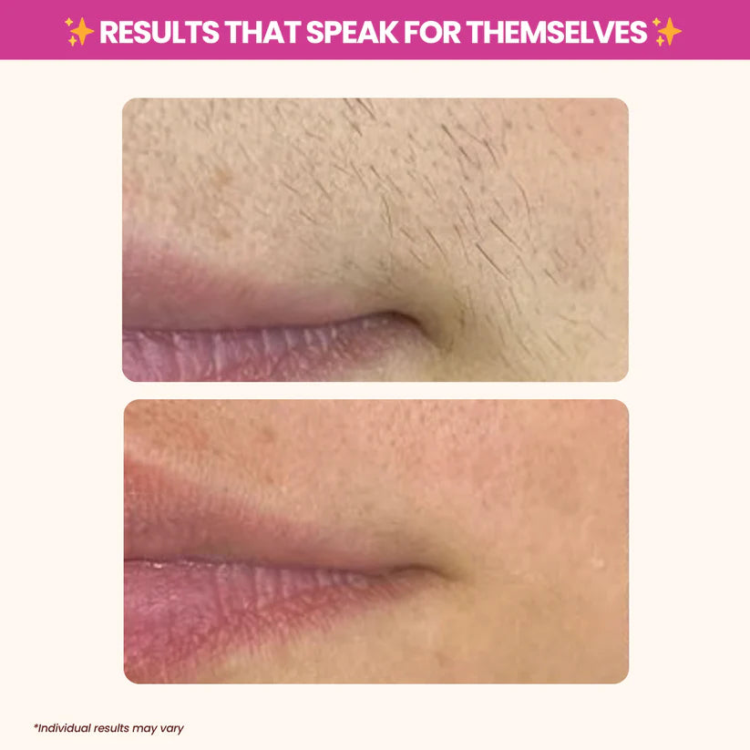 Nood - Cyperus Rotundus Oil for Natural Permanent Hair Reduction