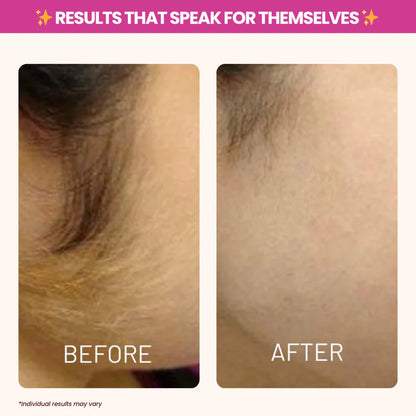 Nood - Cyperus Rotundus Oil for Natural Permanent Hair Reduction