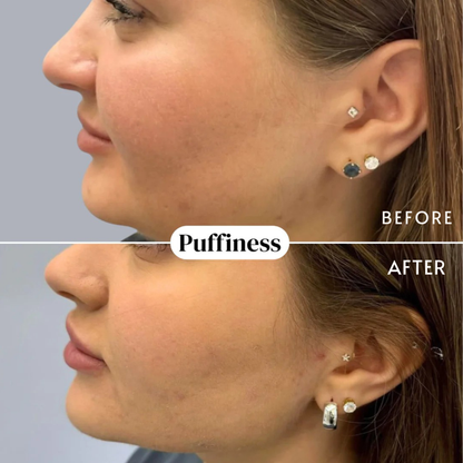 nood - Organic Lymphatic Drainage Drops