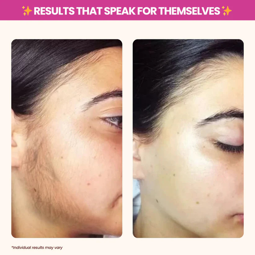 Nood - Cyperus Rotundus Oil for Natural Permanent Hair Reduction