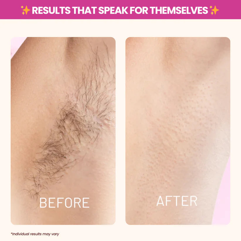 Nood - Cyperus Rotundus Oil for Natural Permanent Hair Reduction