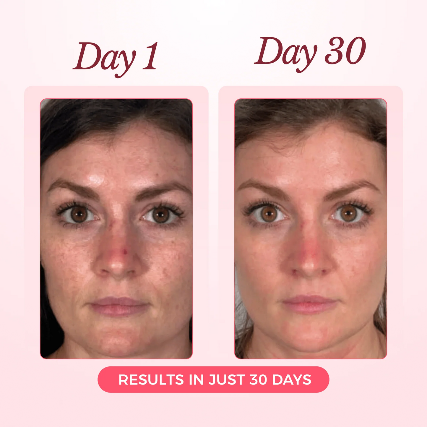 Nood - Collagen Glow Up Mask