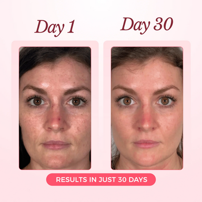Nood - Collagen Glow Up Mask