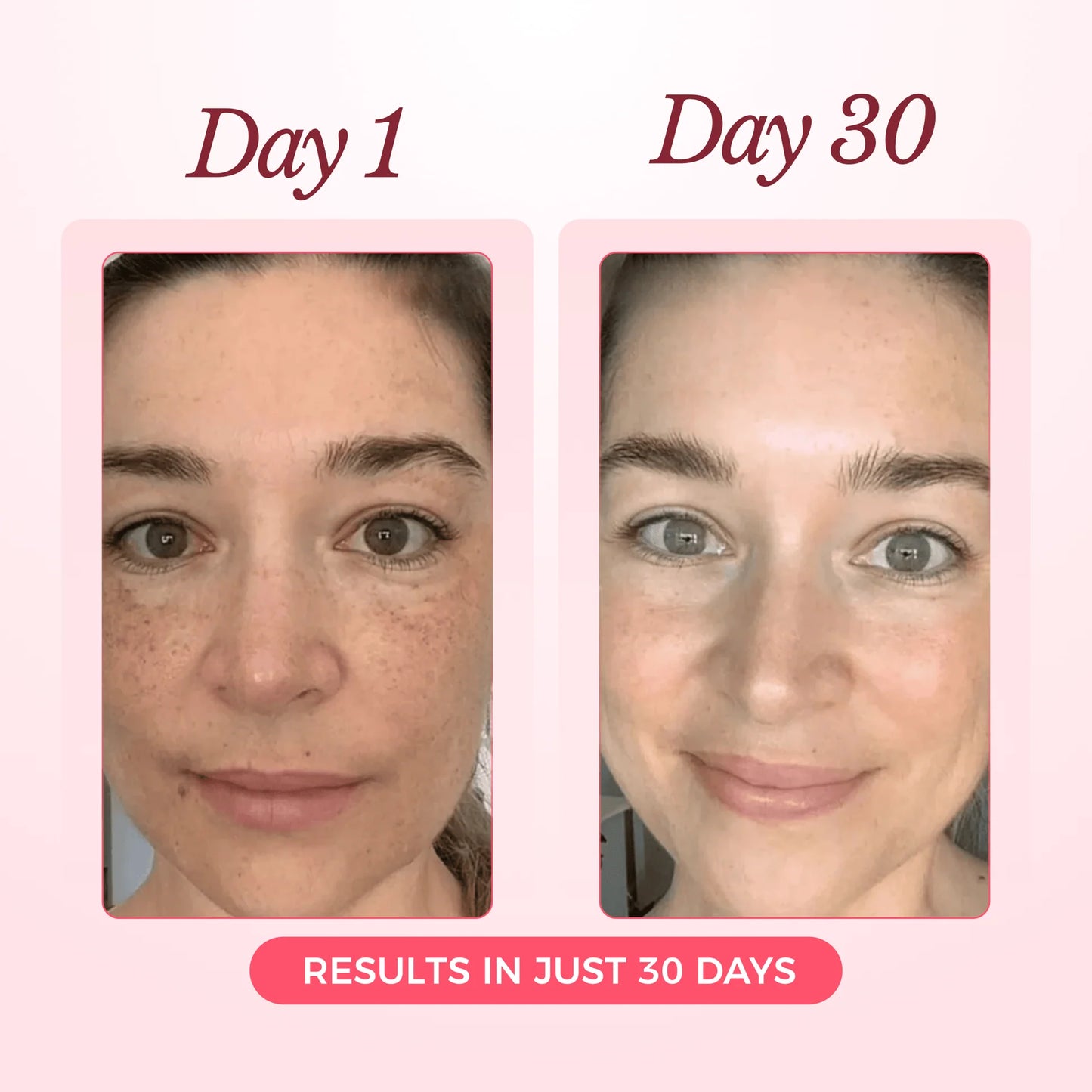 Nood - Collagen Glow Up Mask