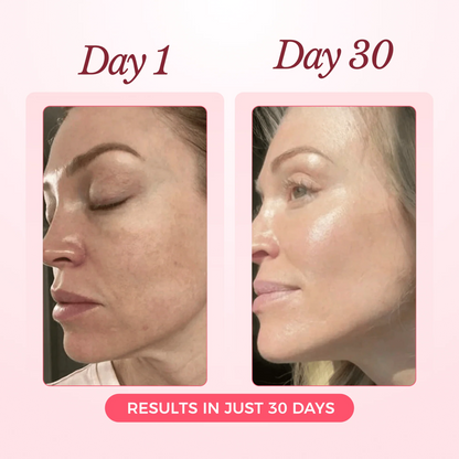 Nood - Collagen Glow Up Mask